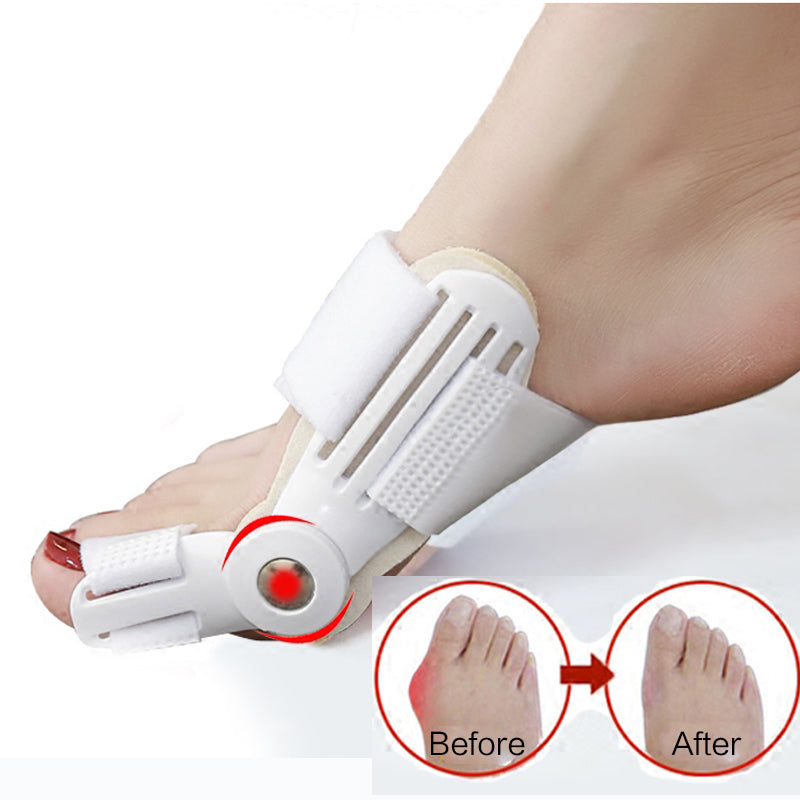 تصحيح إصبع القدم الطبّية